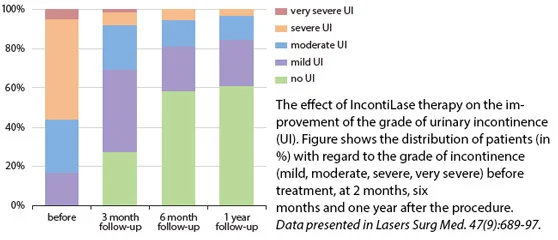 Stress Urinary Incontinence Treatment Courtesy of: Urska B. Ogrinc, MD & Sabina Sencar, MD & Helena Lenasi, MD Laser source: Non-Ablative Er:YAG