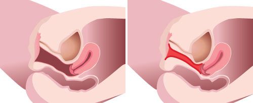 Copy of Illustrative Before & After