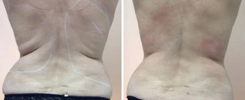 Copy of Before & After