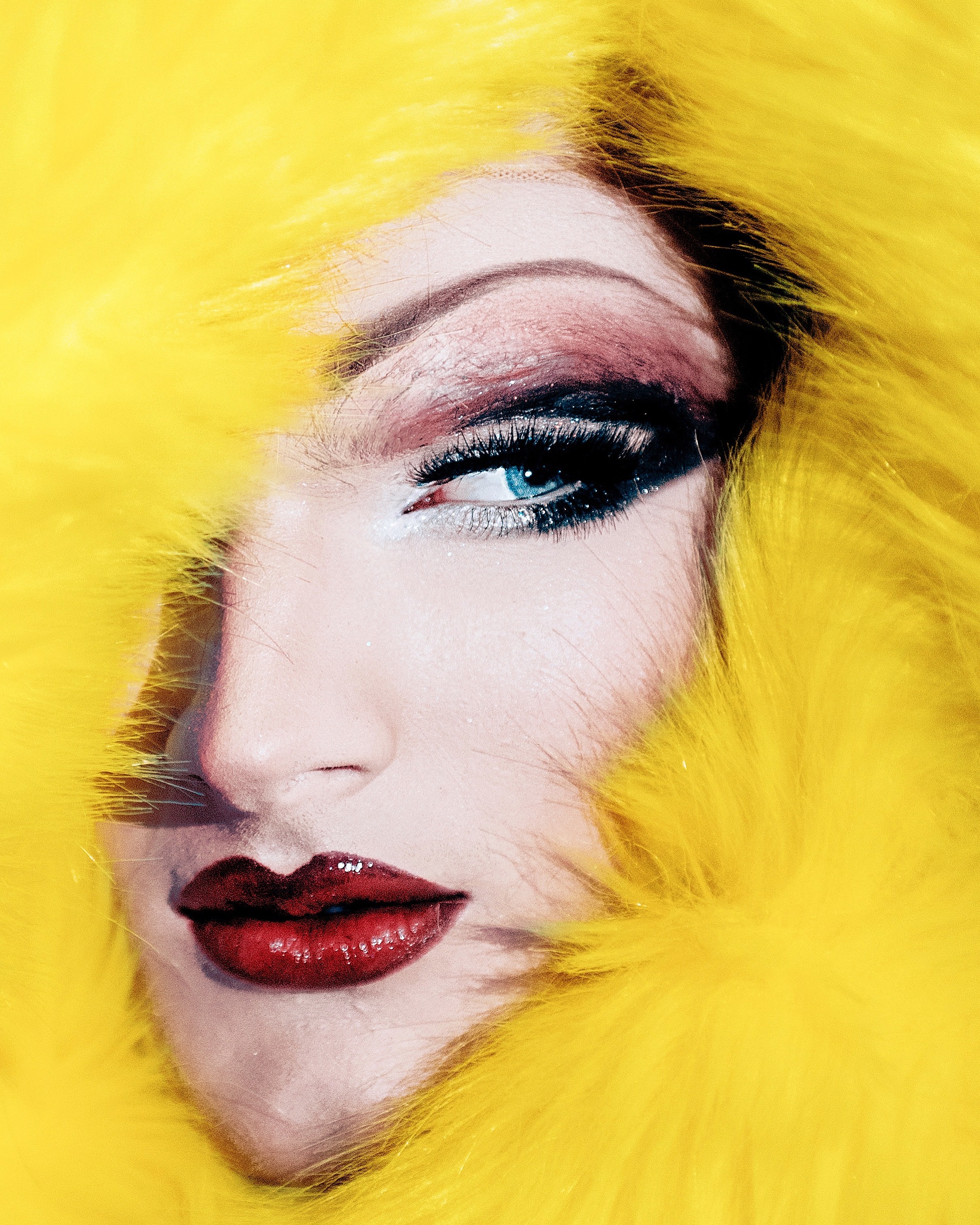 LipLase.  A viable alternative to fillers?