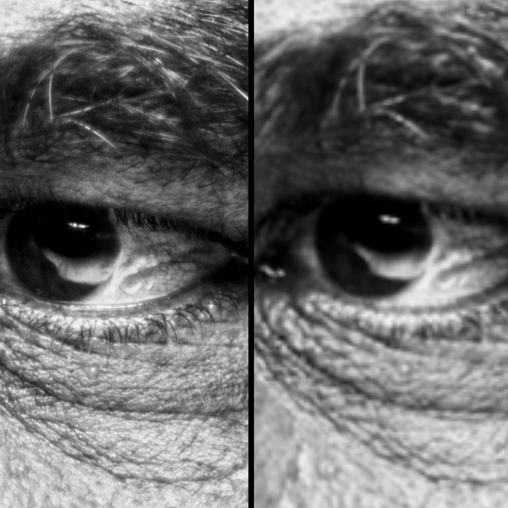 Close-up black-and-white photo of an older person's eye with details of the eyelid, eyelashes, and surrounding wrinkles, comparing standard versus high resolution scan detail.