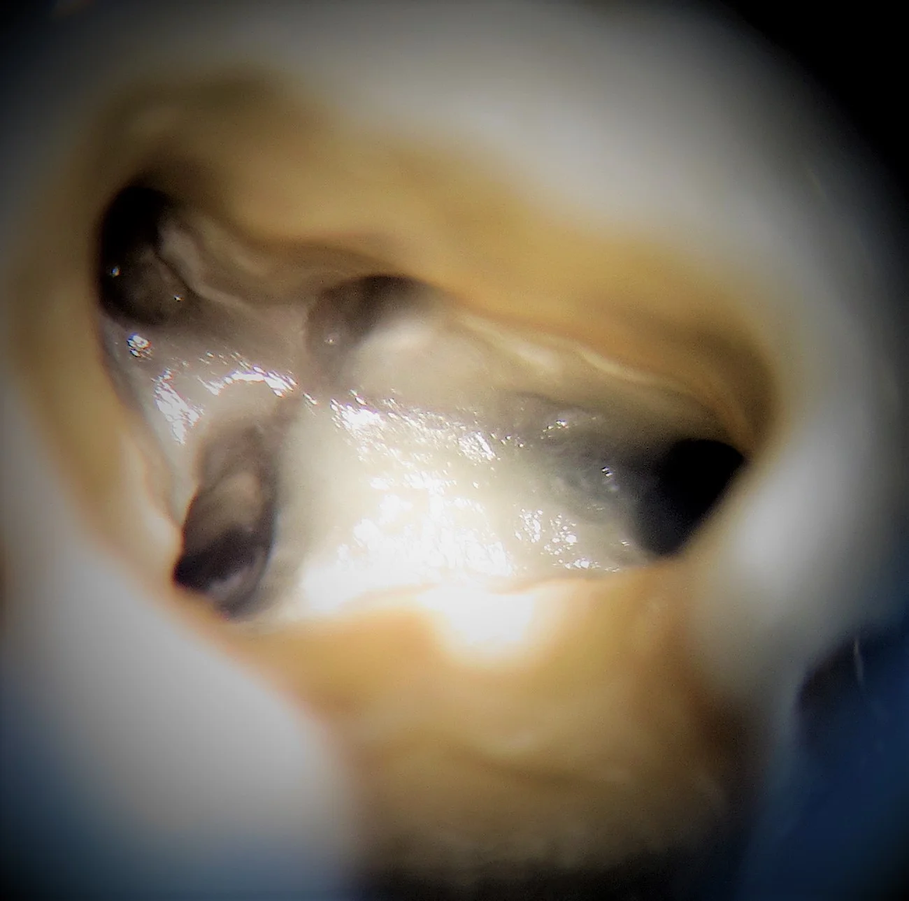 Examples of our work at Norfolk Endodontics