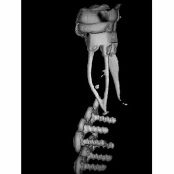 Examples of our work at Norfolk Endodontics