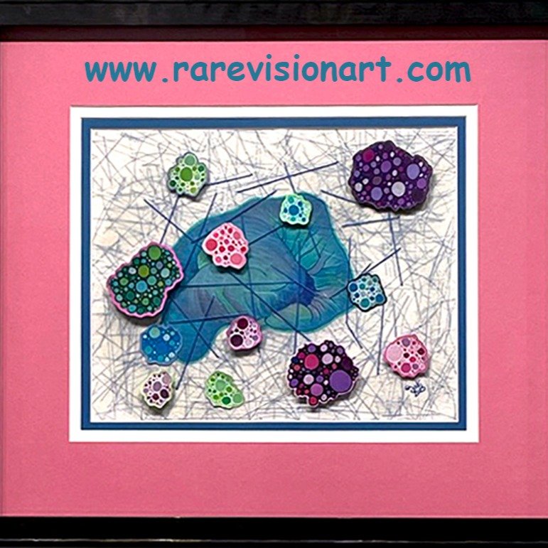 RARE VISION Exhibit Statement
TAG The Art Gallery
460C Harrison Avenue, Boston, MA
October 31 &ndash; November 2
To benefit the Neuroimmunology Clinic and Research Laboratory at Massachusetts General Hospital
Rare Vision is a celebration of the human