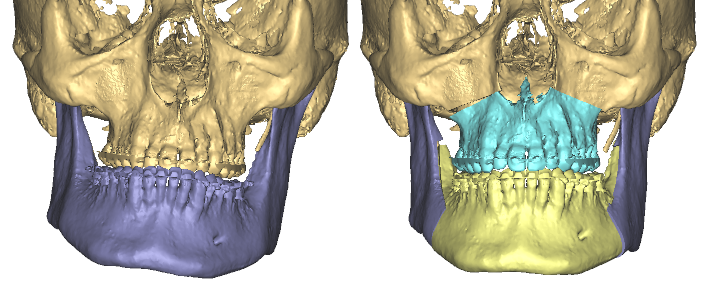 Front Comparison.png