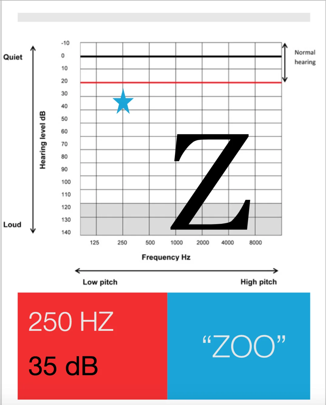 phoneme Z.jpg