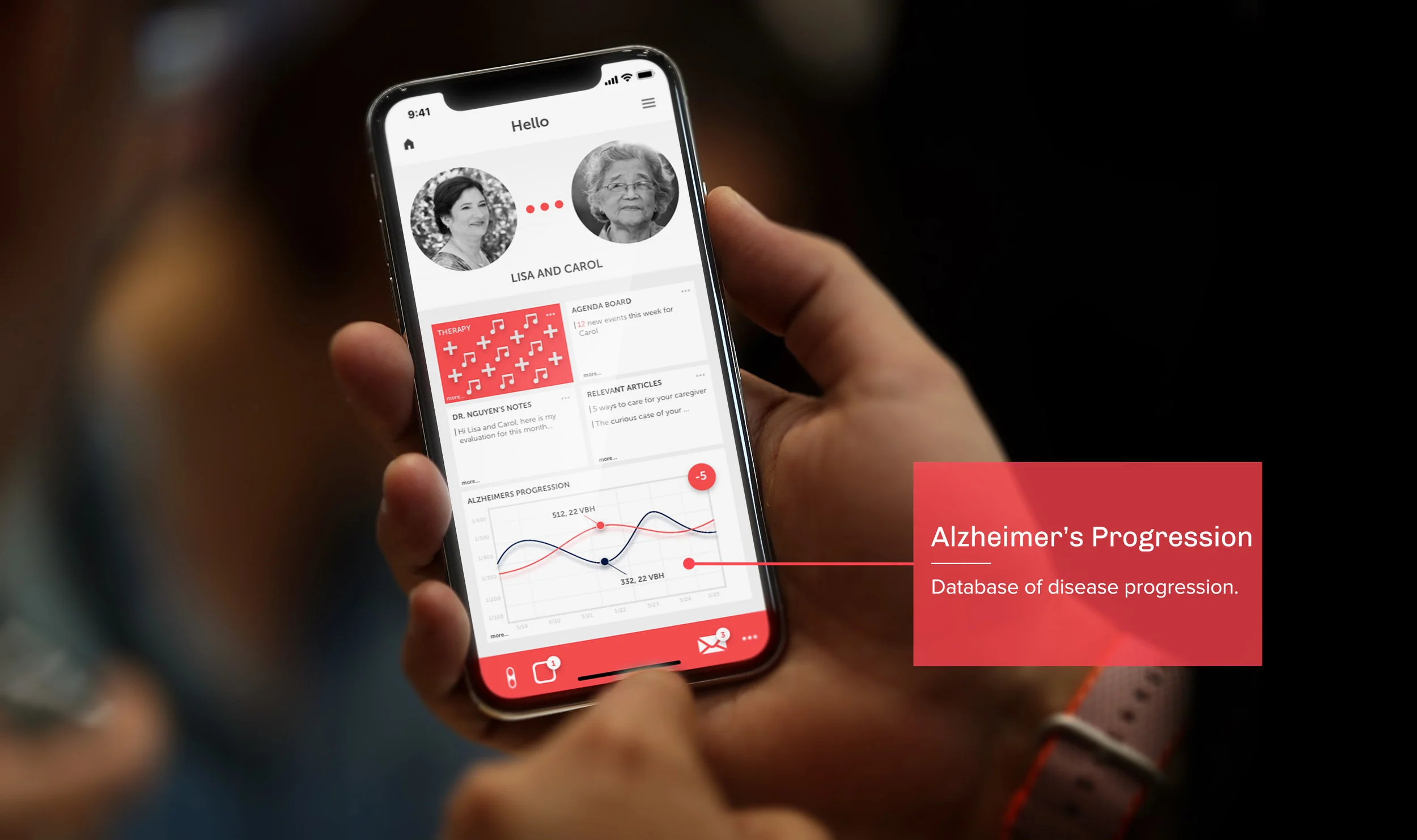 Alzheimer's progression.jpg