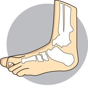 Mallet Toes