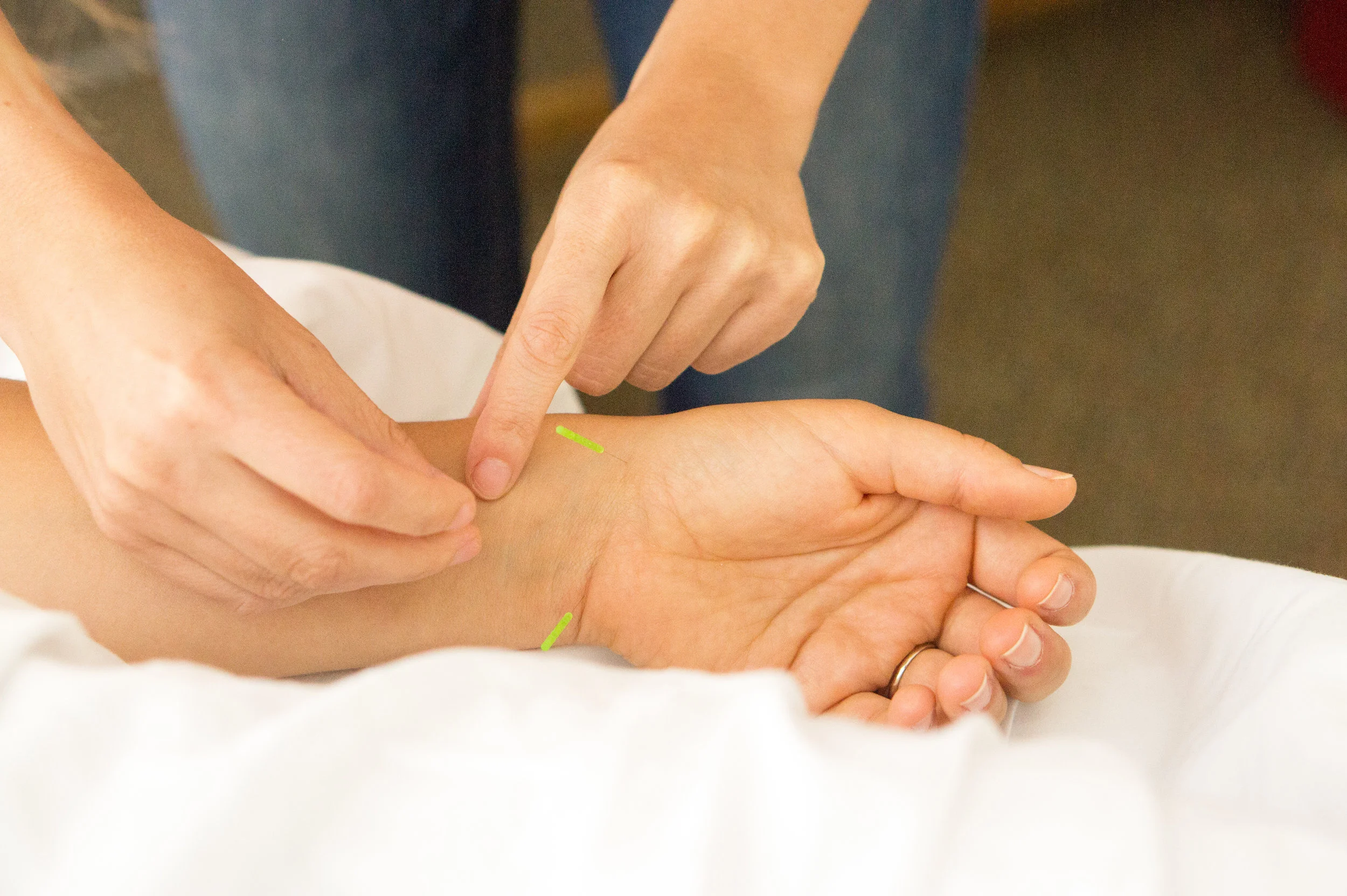 Acupuncture Wrist 2.jpg