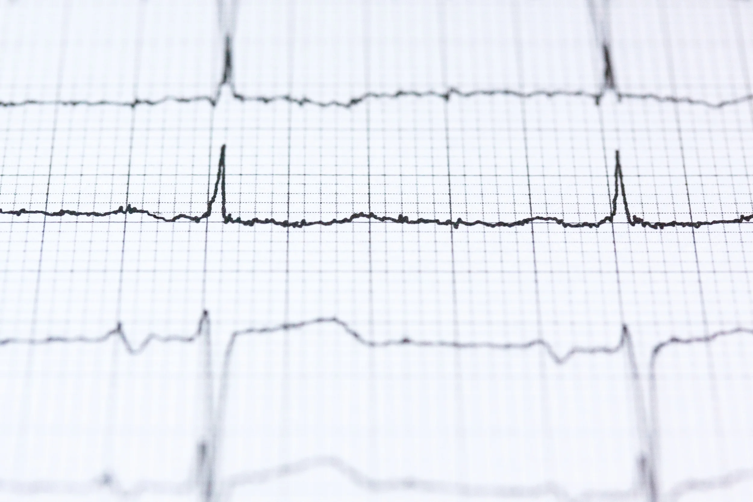 blur-chart-check-up-415779.jpg