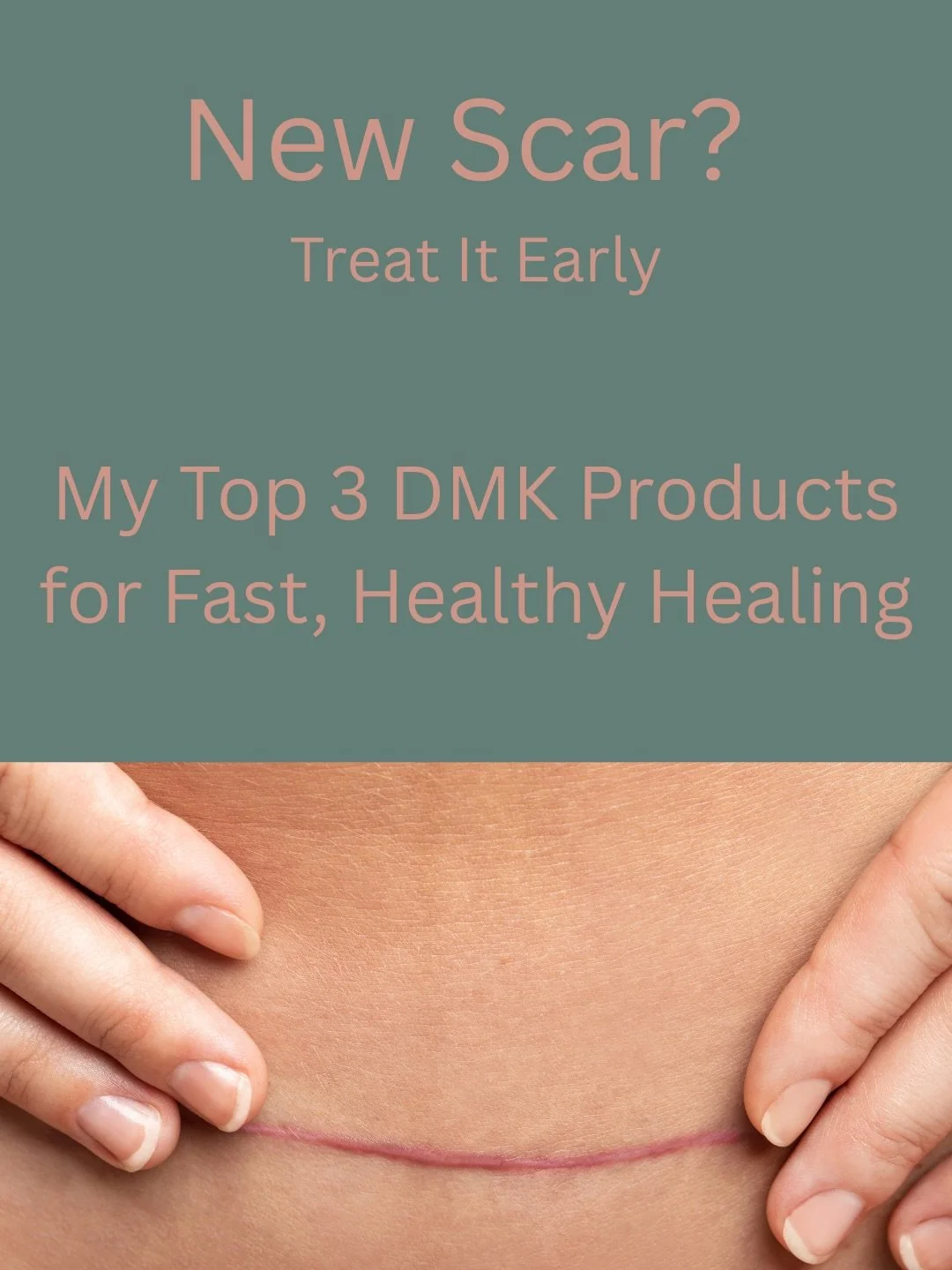 New scars don&rsquo;t have to linger.
Here are my top 3 DMK picks to help calm, lighten, and smooth fresh scars and marks:

💗Melanotech Drops - Targets excess pigment before it settles.
💗 Beta Gel -  Reduces swelling, redness, and inflammation. 
💗