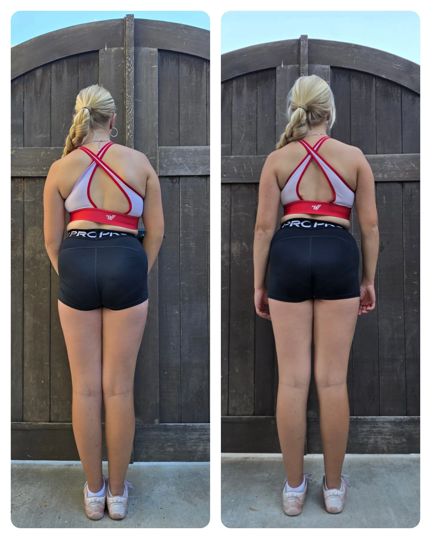 Before and After the 1st Appointment for an Adolescent with a severe S-curve