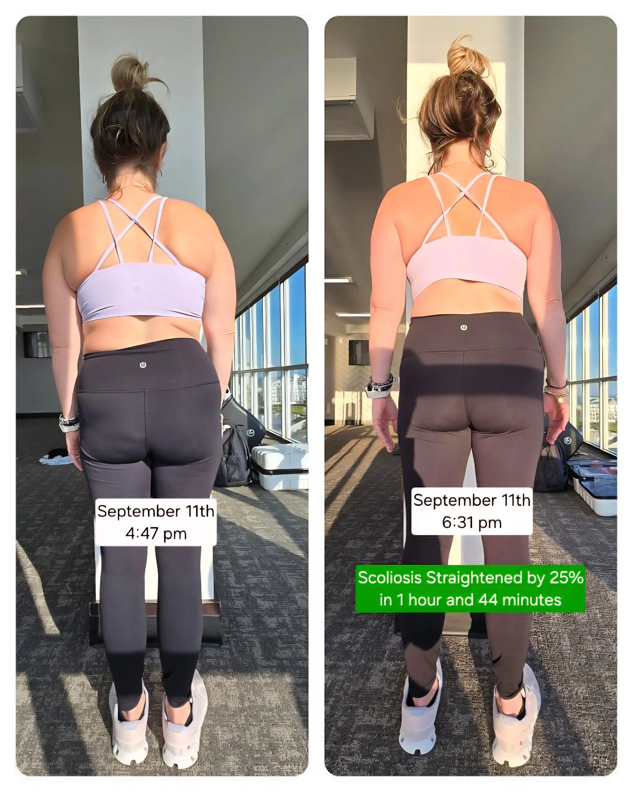 First Appointment for an Adult with scoliosis