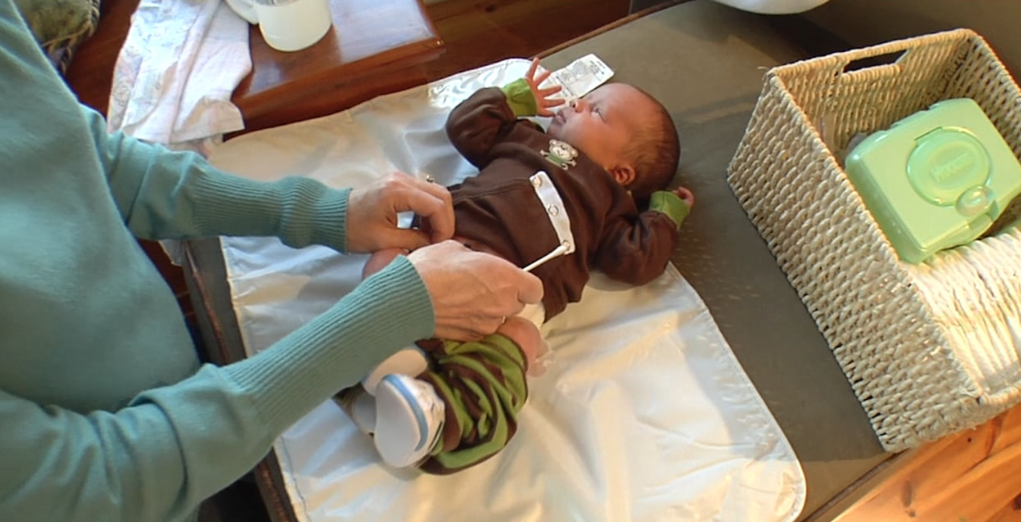 Umbilical Cord Care (PFPV5-14S)