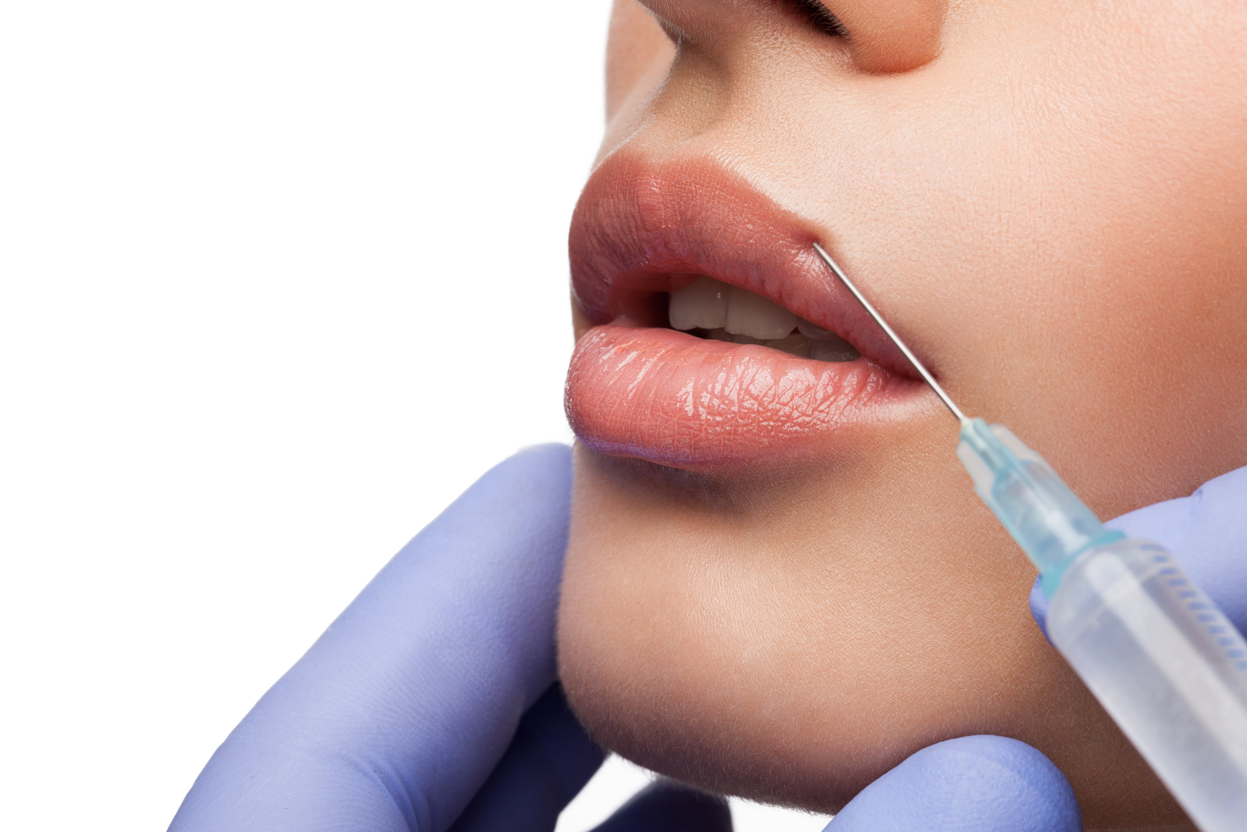 Juvederm