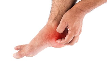 Why Your Feet Are Red - Four Possible Causes — Westfield Foot and