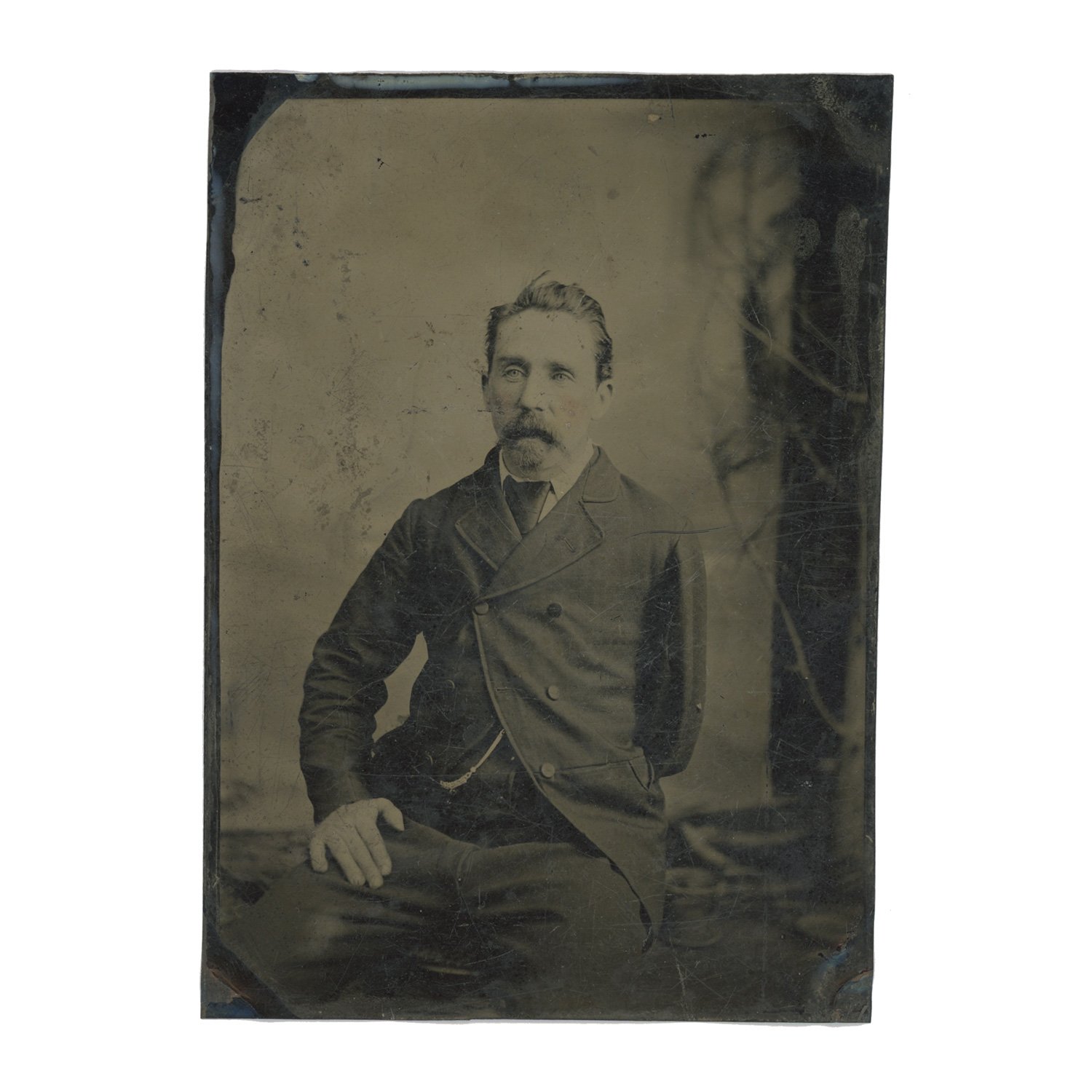 tintype-amputee.jpg
