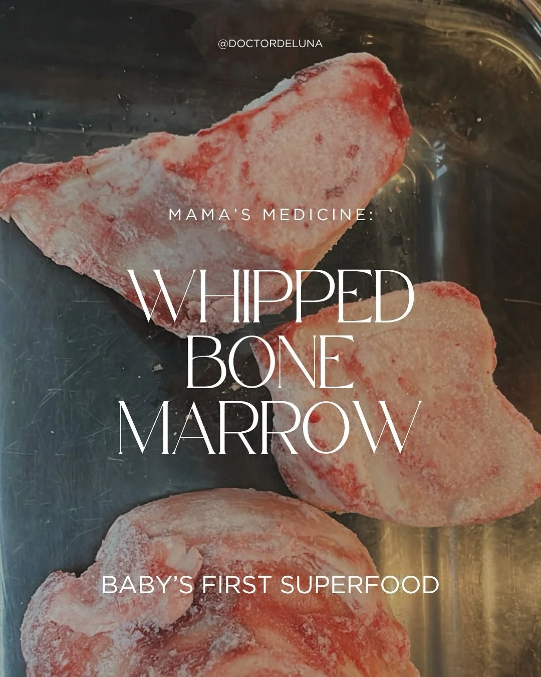 🥩 Whipped Bone Marrow: Baby&rsquo;s First Superfood🔥

Around 6 months, your baby&rsquo;s iron stores start running low, and that&rsquo;s when you want real, nourishing foods on the menu. Bone marrow is packed with:
🩸 Heme iron your baby can actual