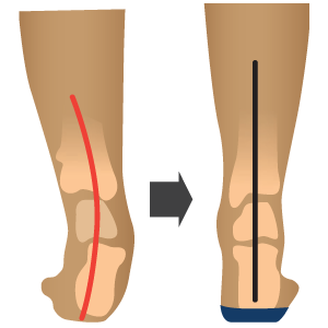 align foot.png
