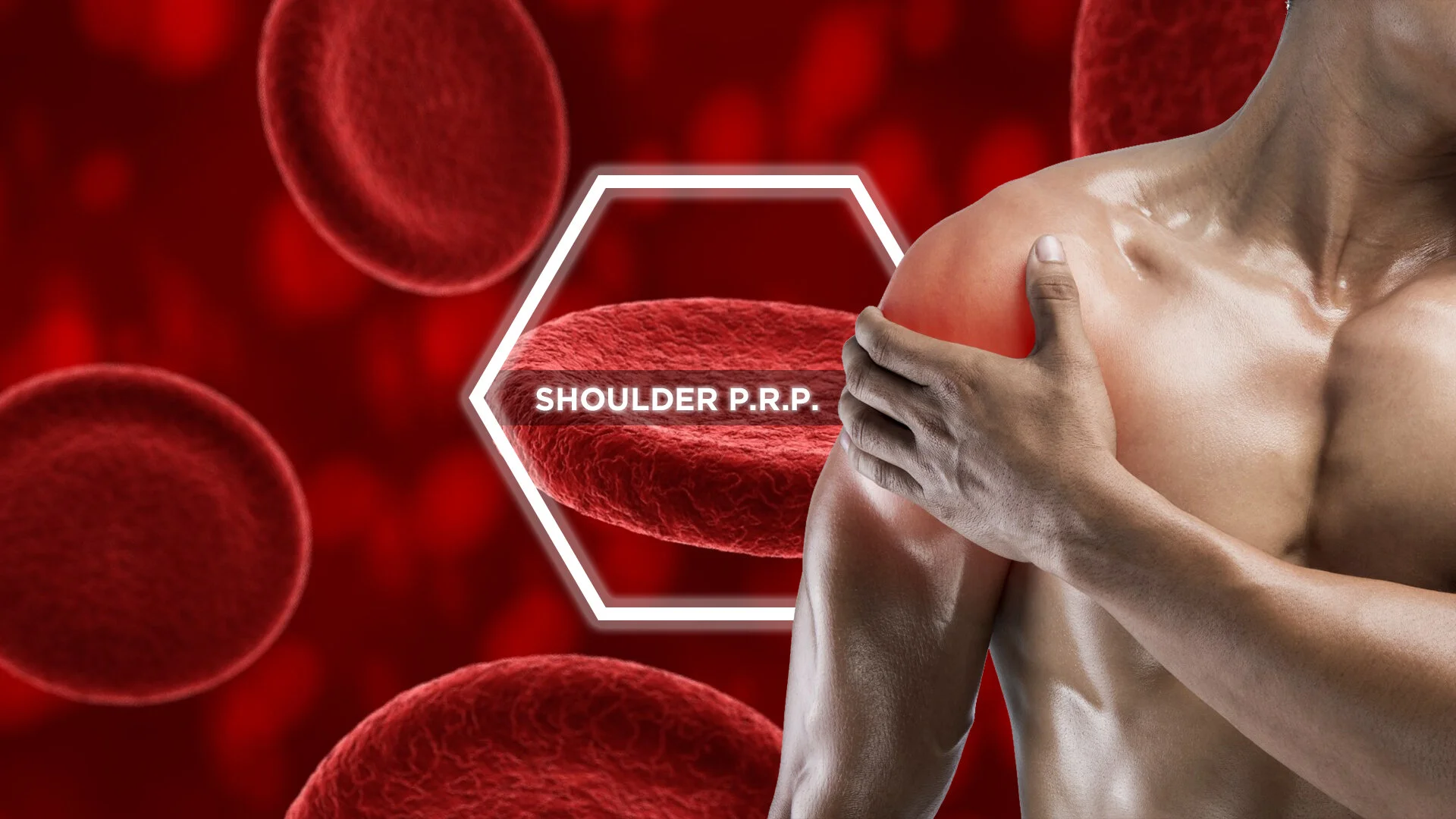 shoulder prp.jpg