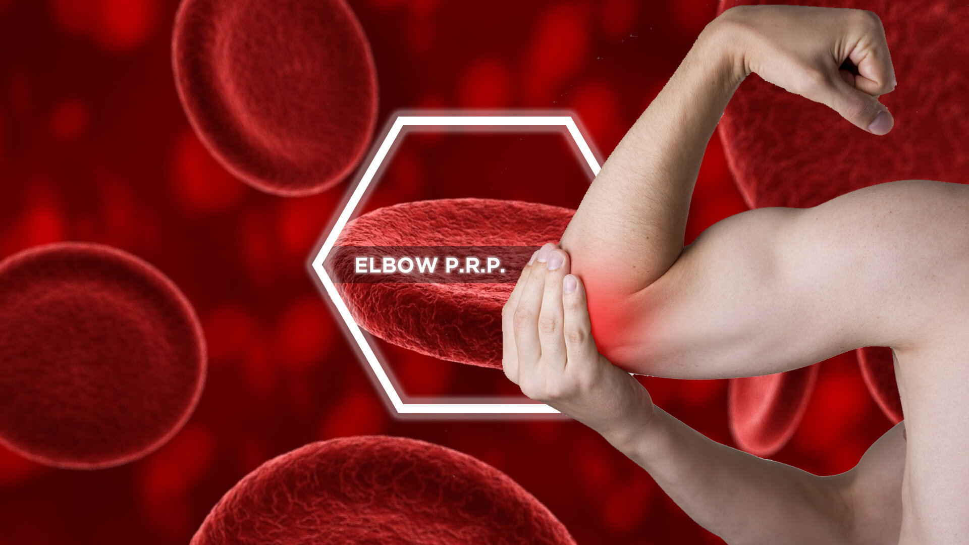 elbow prp.jpg