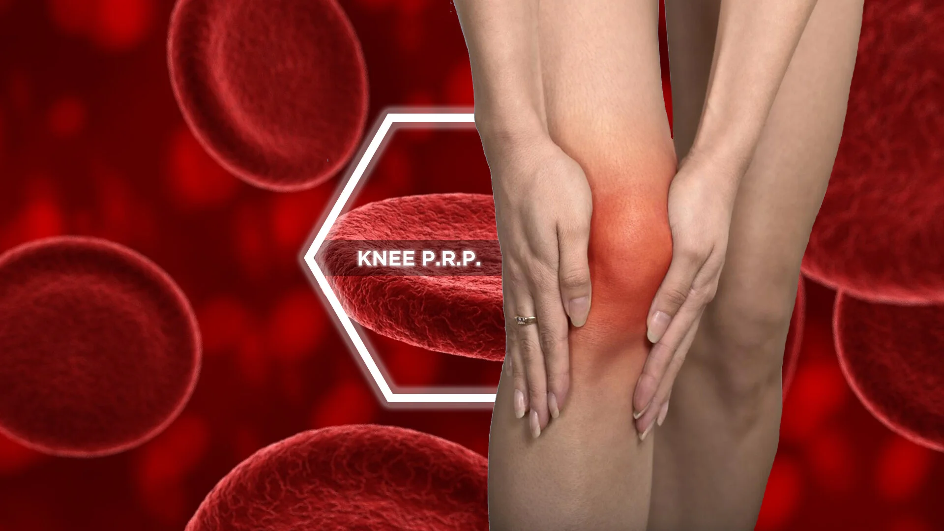 knee prp.jpg