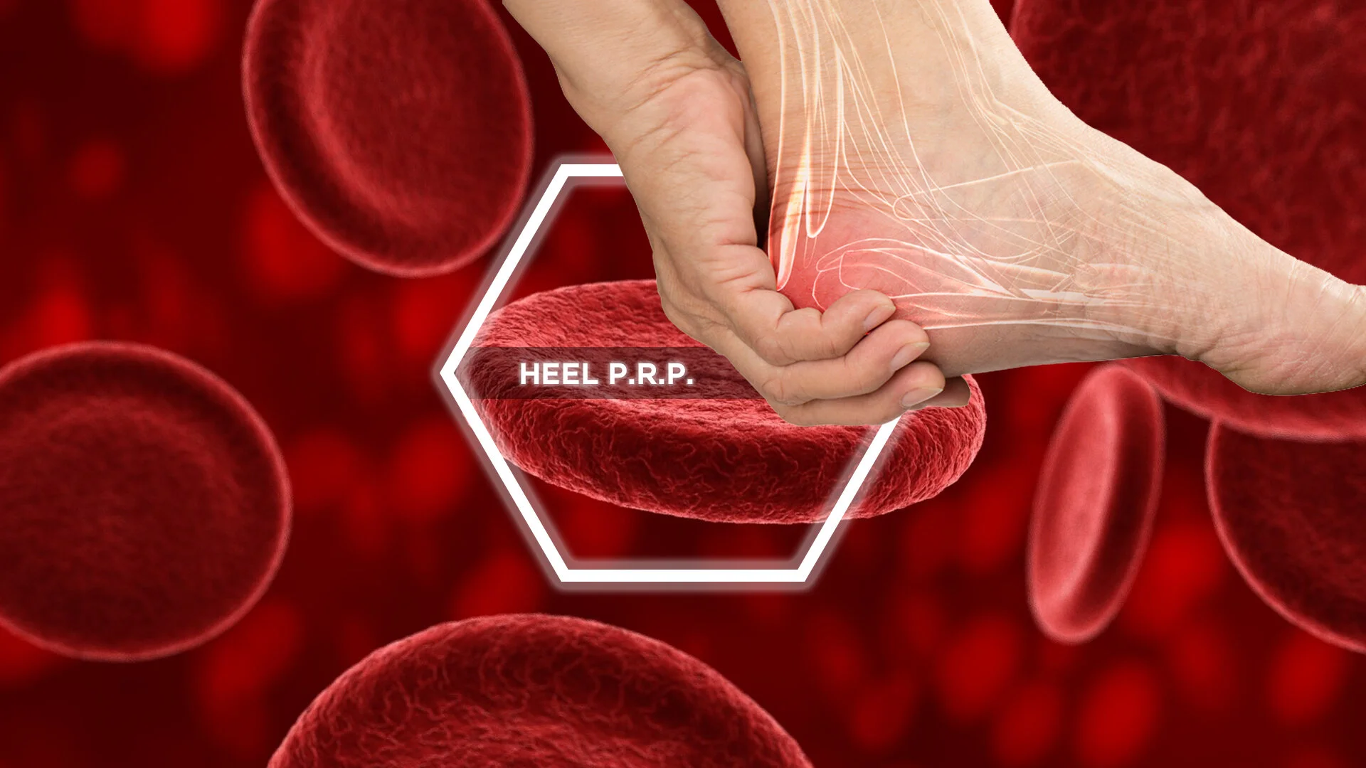 heel prp.jpg