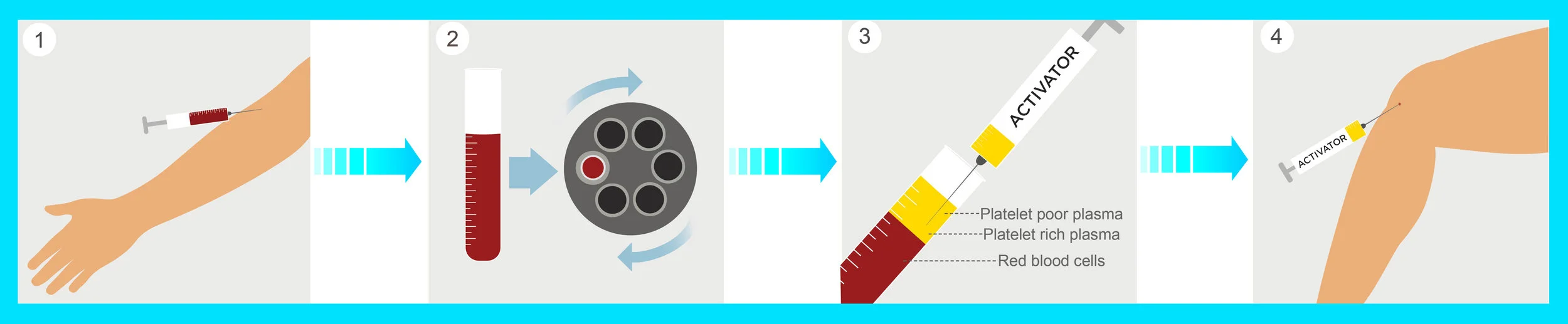 How it Works (PRP)1.jpg