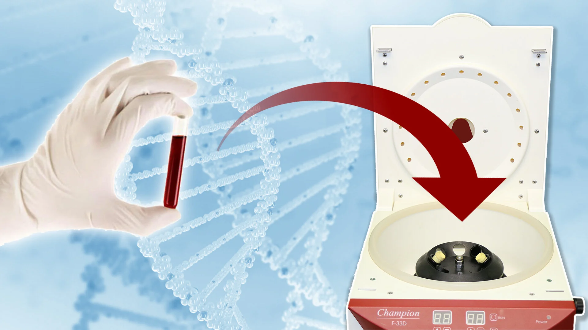 PRP Step 2 Centrifuge.jpg