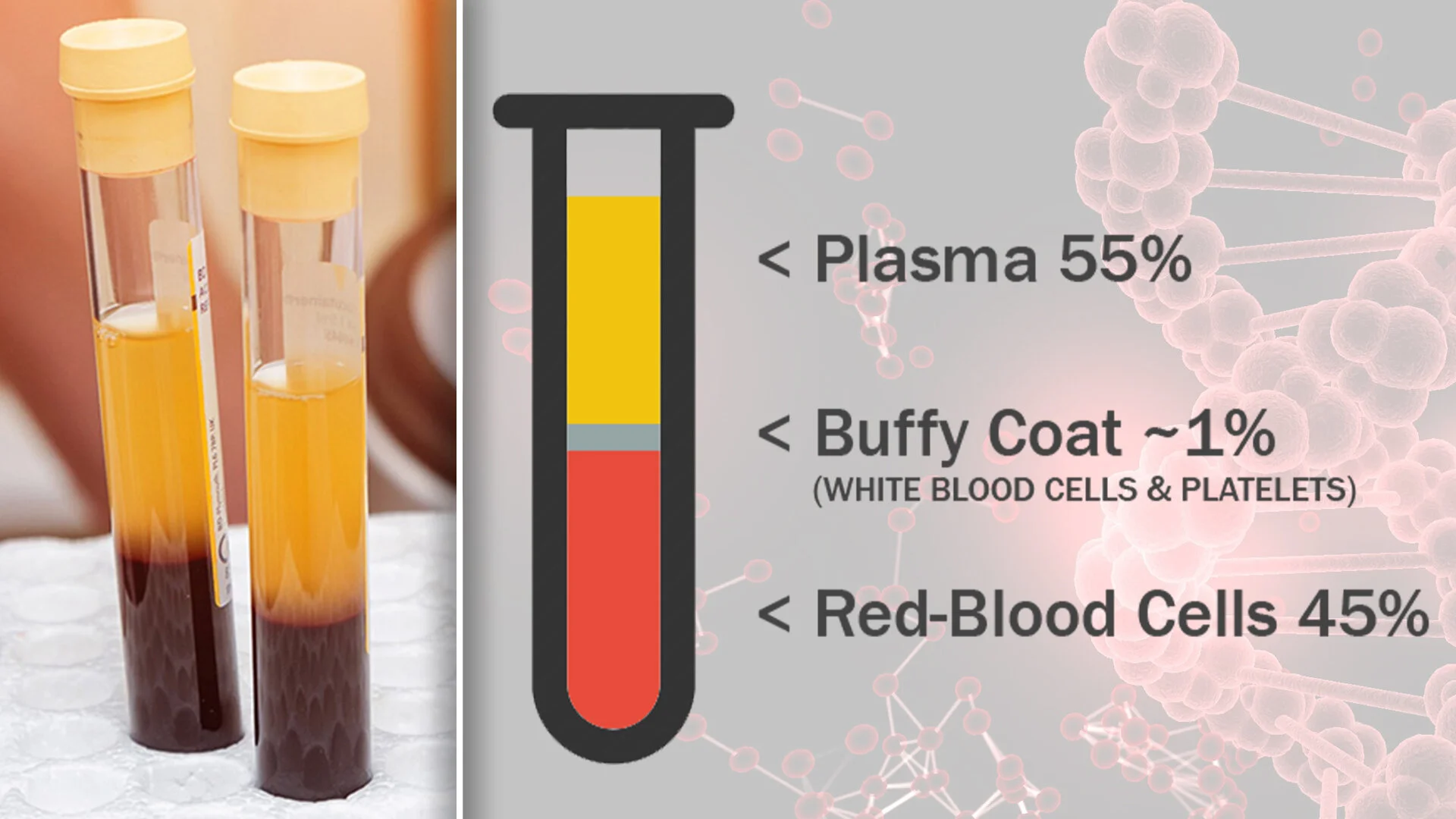 prp step 2 plasma components.jpg