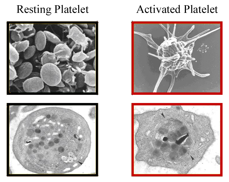 Resting+platelet vs Activated+platelet.png