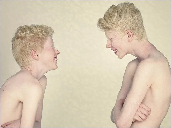 albino13-–-kopie.jpg