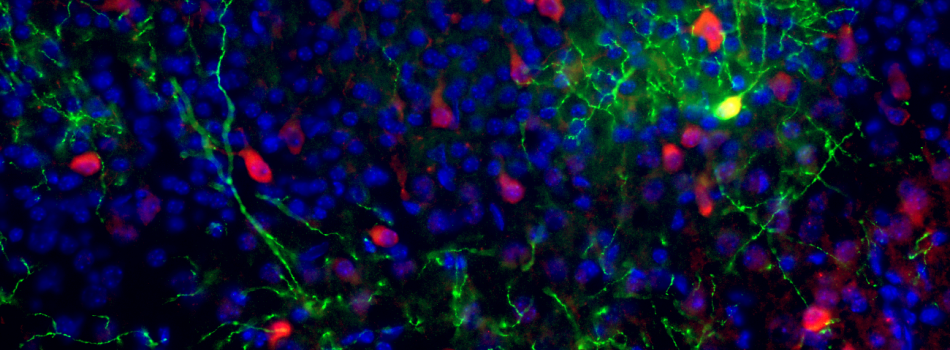 Basket and Martinotti Cells (Copy)