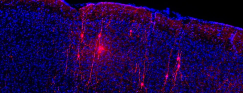 VIP Chat Interneurons