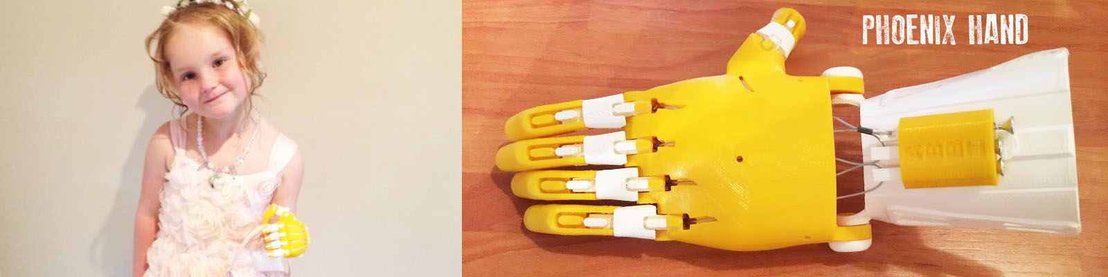 Image Source: http://enablingthefuture.org/upper-limb-prosthetics/