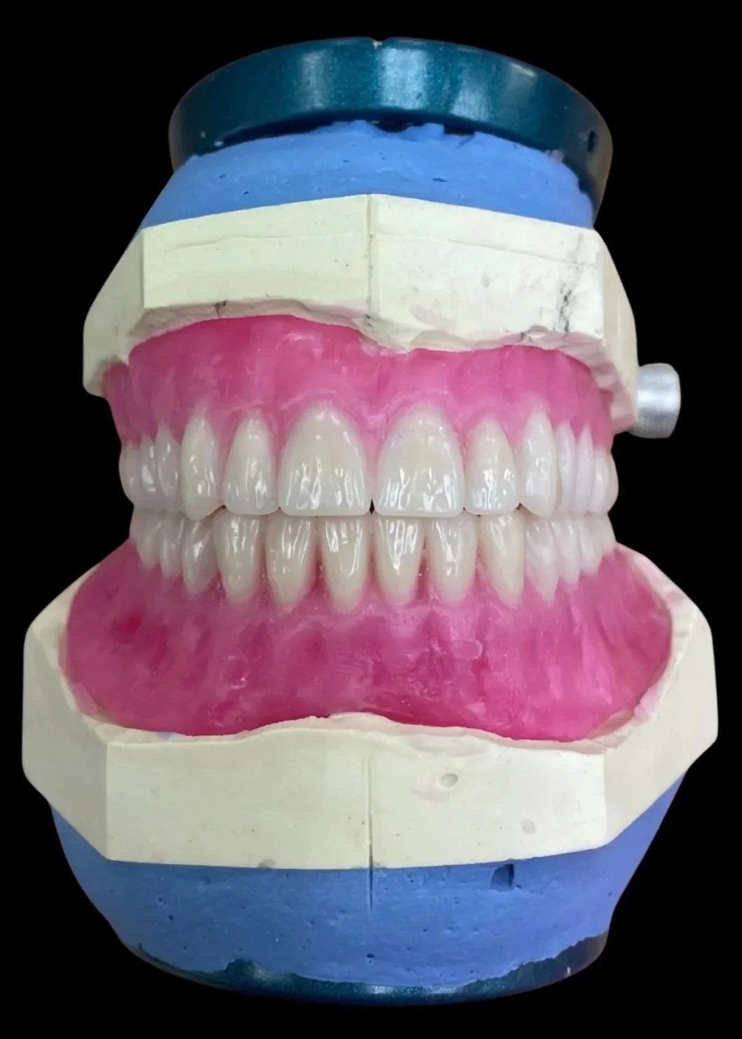 Set of handmade dentures by Adelaide Laboratories prosthetics studio