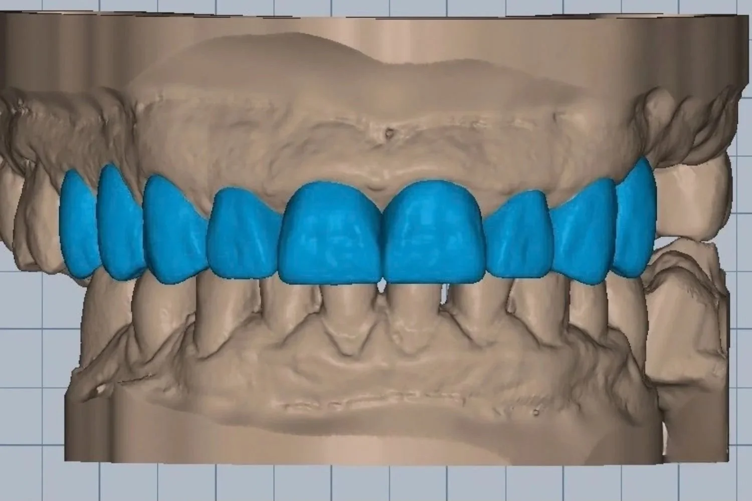 SmileDesign.jpg