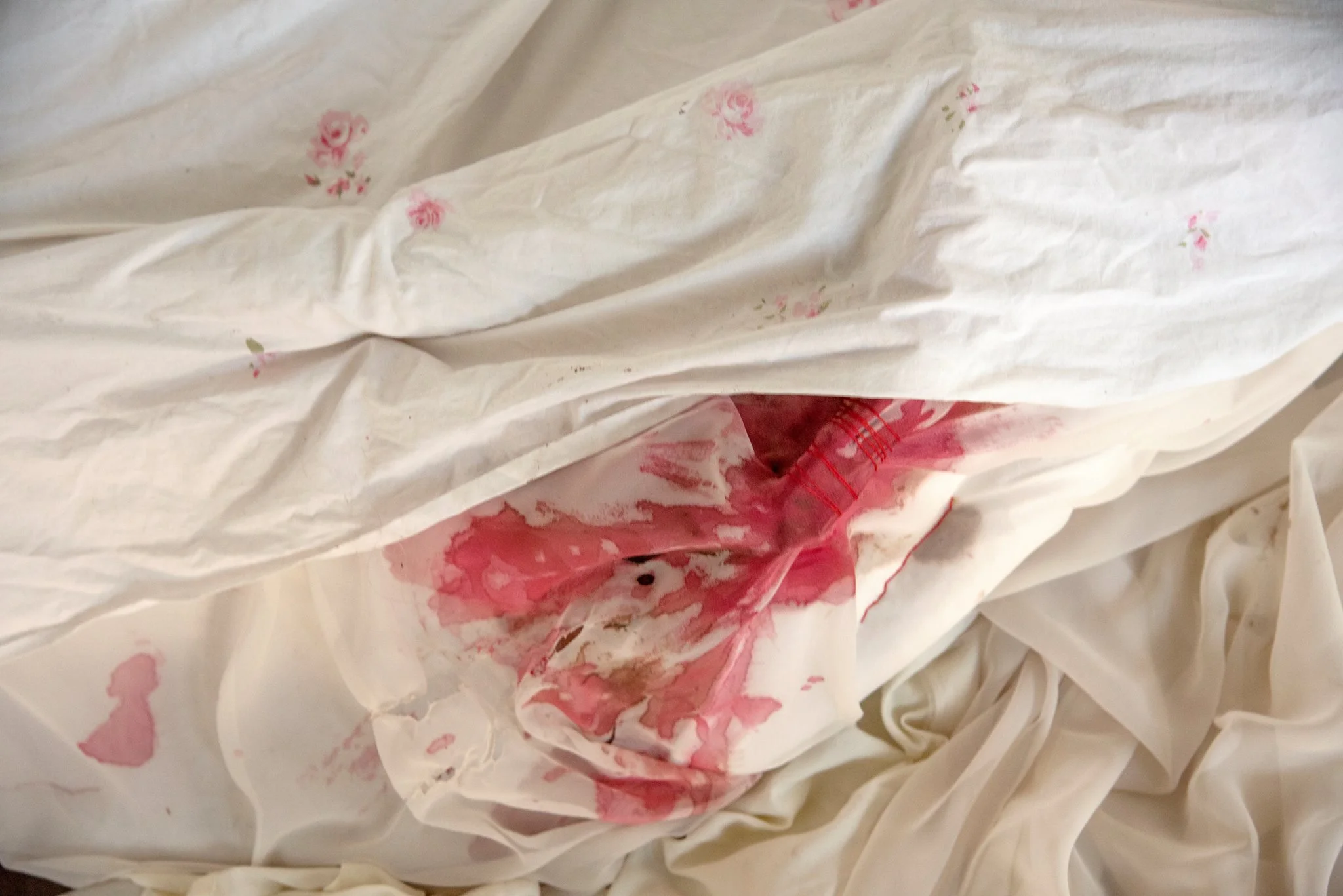 Waiting for an Infection to Spread like Blood Poisoning (Detail)