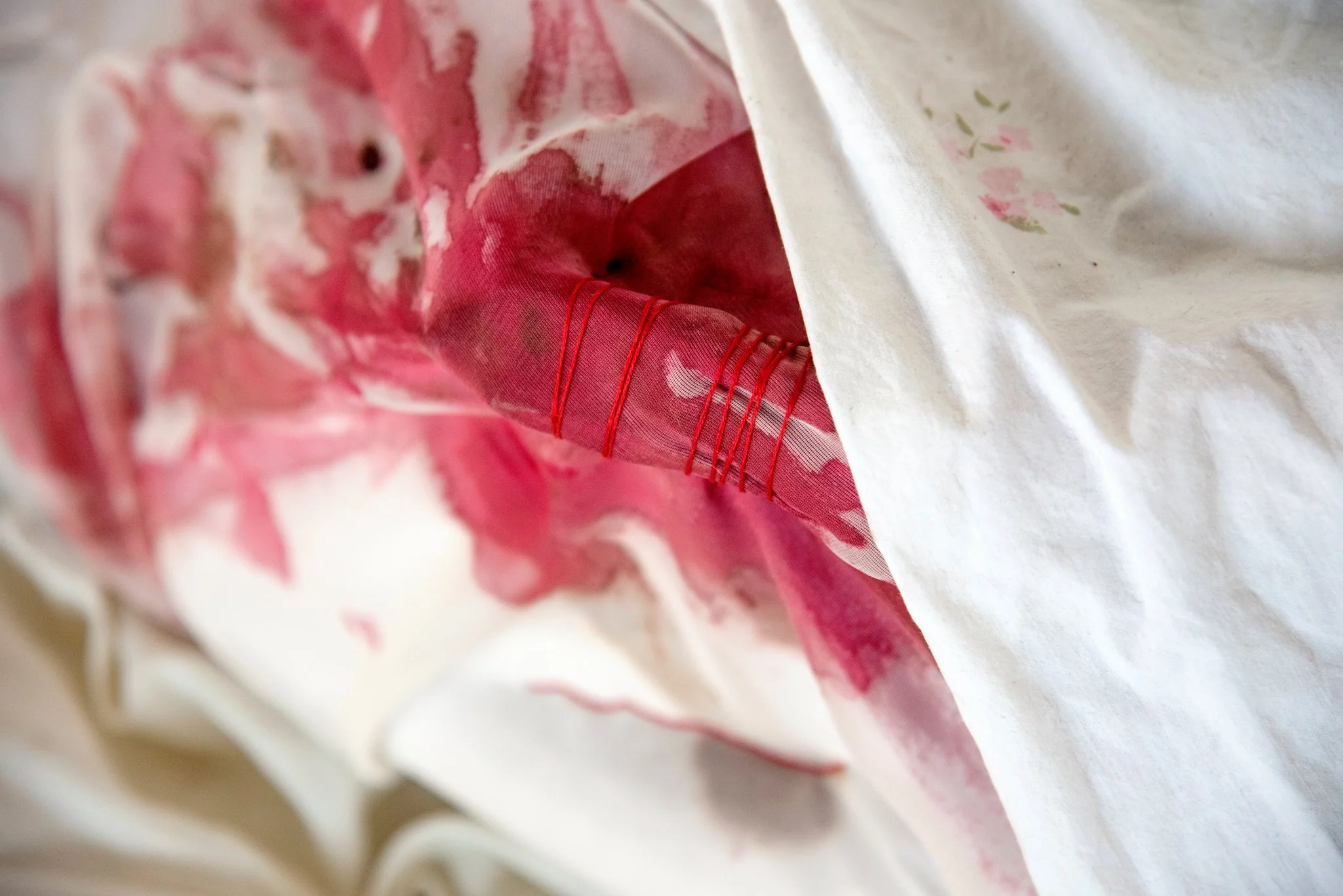 Waiting for an Infection to Spread like Blood Poisoning (Detail)