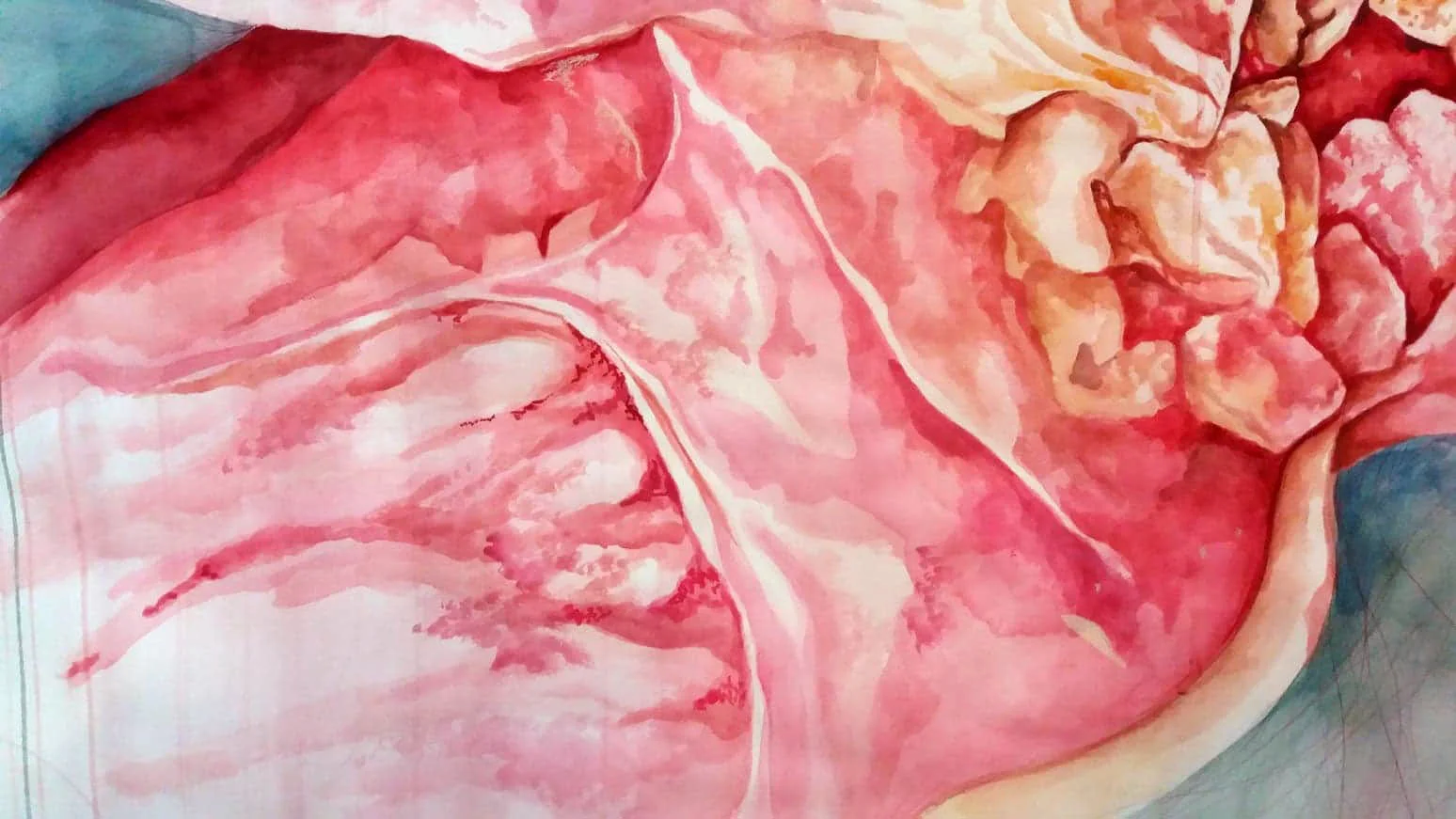 Rotten Soft Slit (Detail)