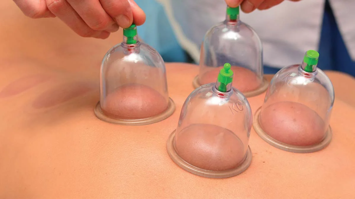 cupping-wellness.jpg