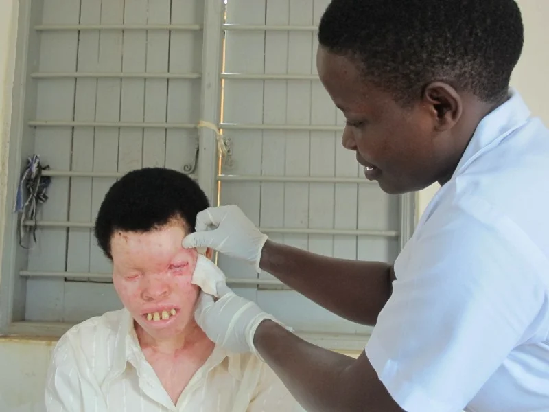 Advantage Africa is helping people with albinism to have life-saving surgery for skin cancer. Sarah had cancer around her eye and on her neck and chest. She is now completely free of cancer and returned home to the overwhelming joy of her children and family.