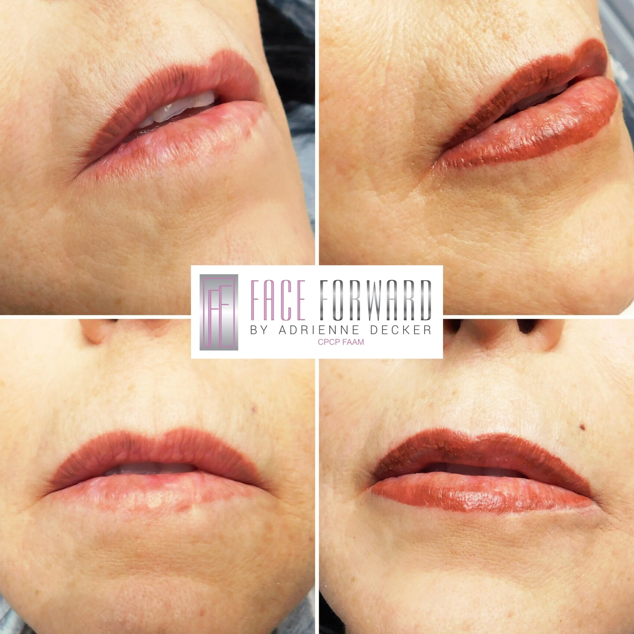 Ombrè Shaded Permanent Lip Color over scaring