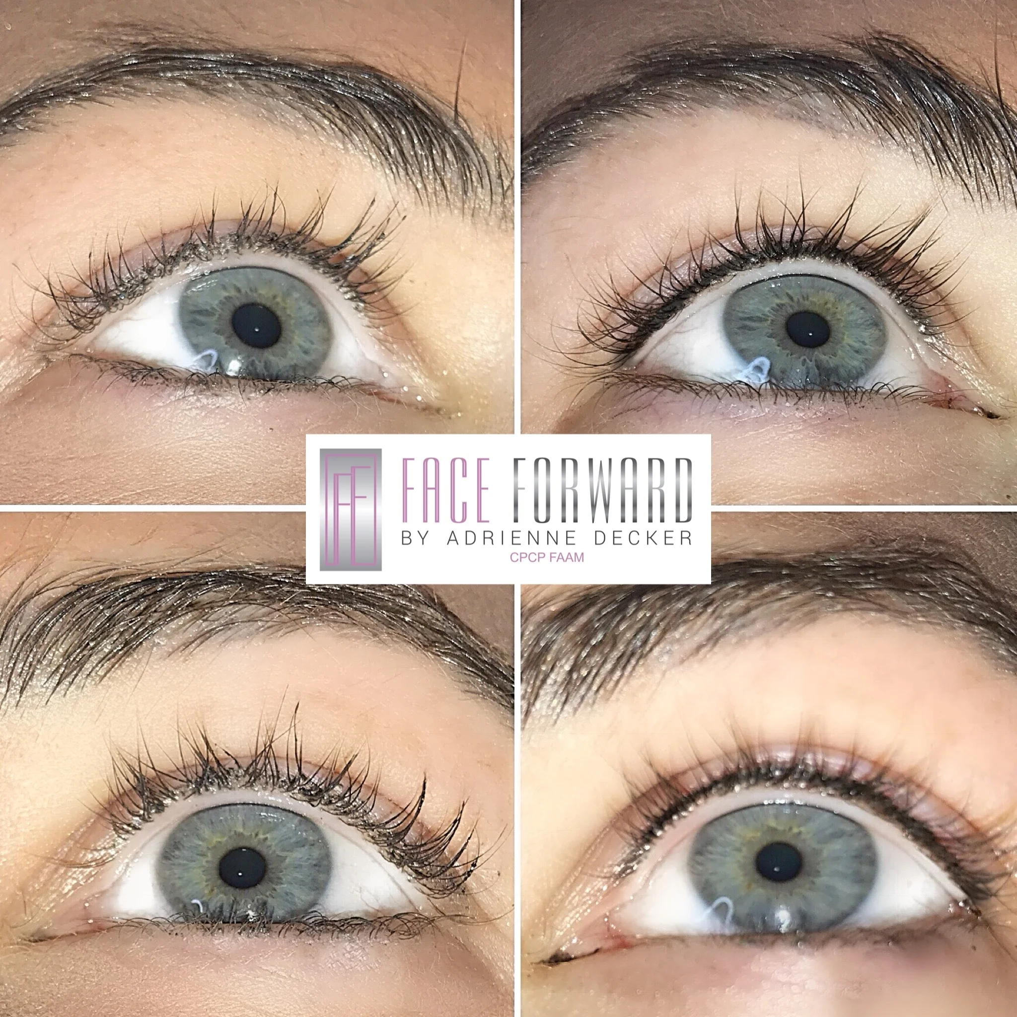 Upper Permanent Lash Line Enhancement
