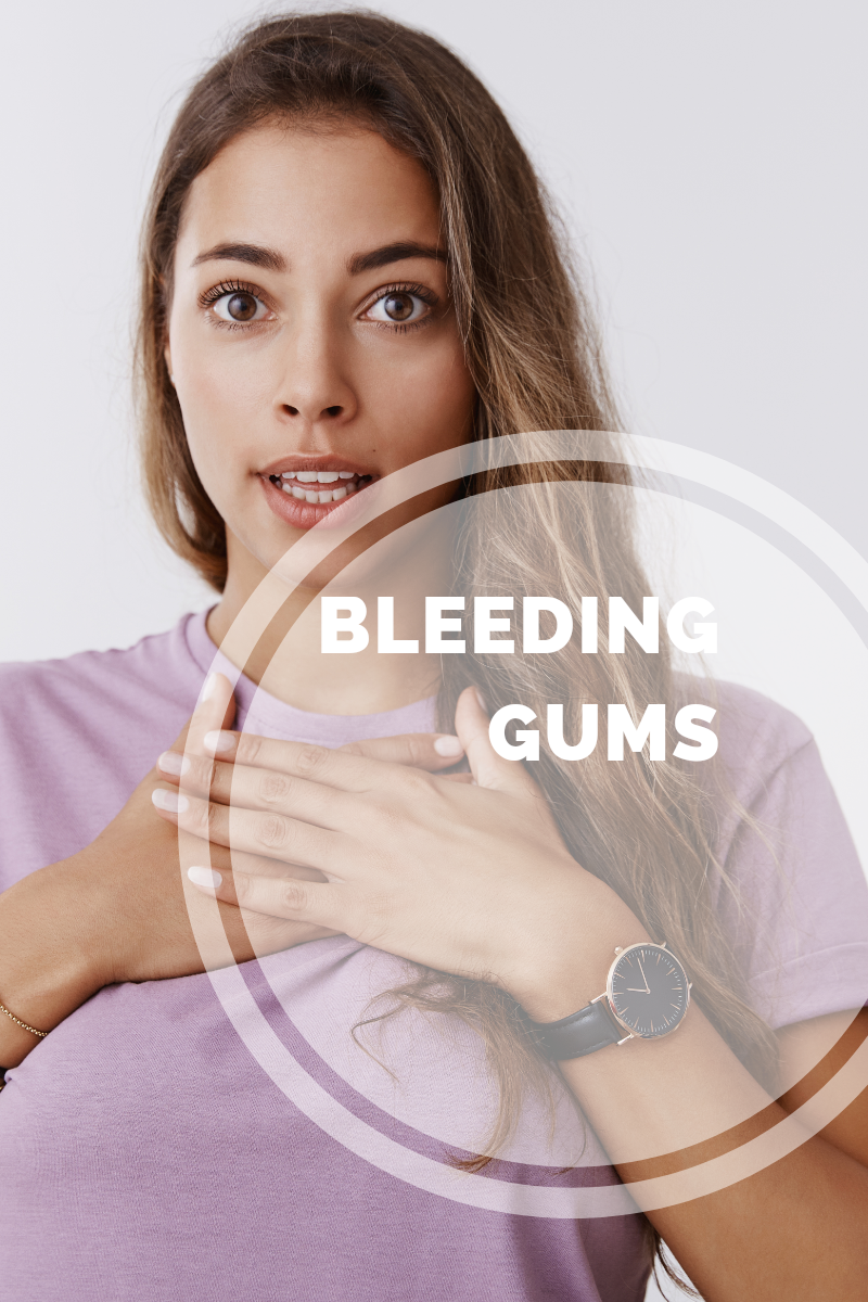 Bleeding Gums