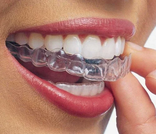 Invisalign
