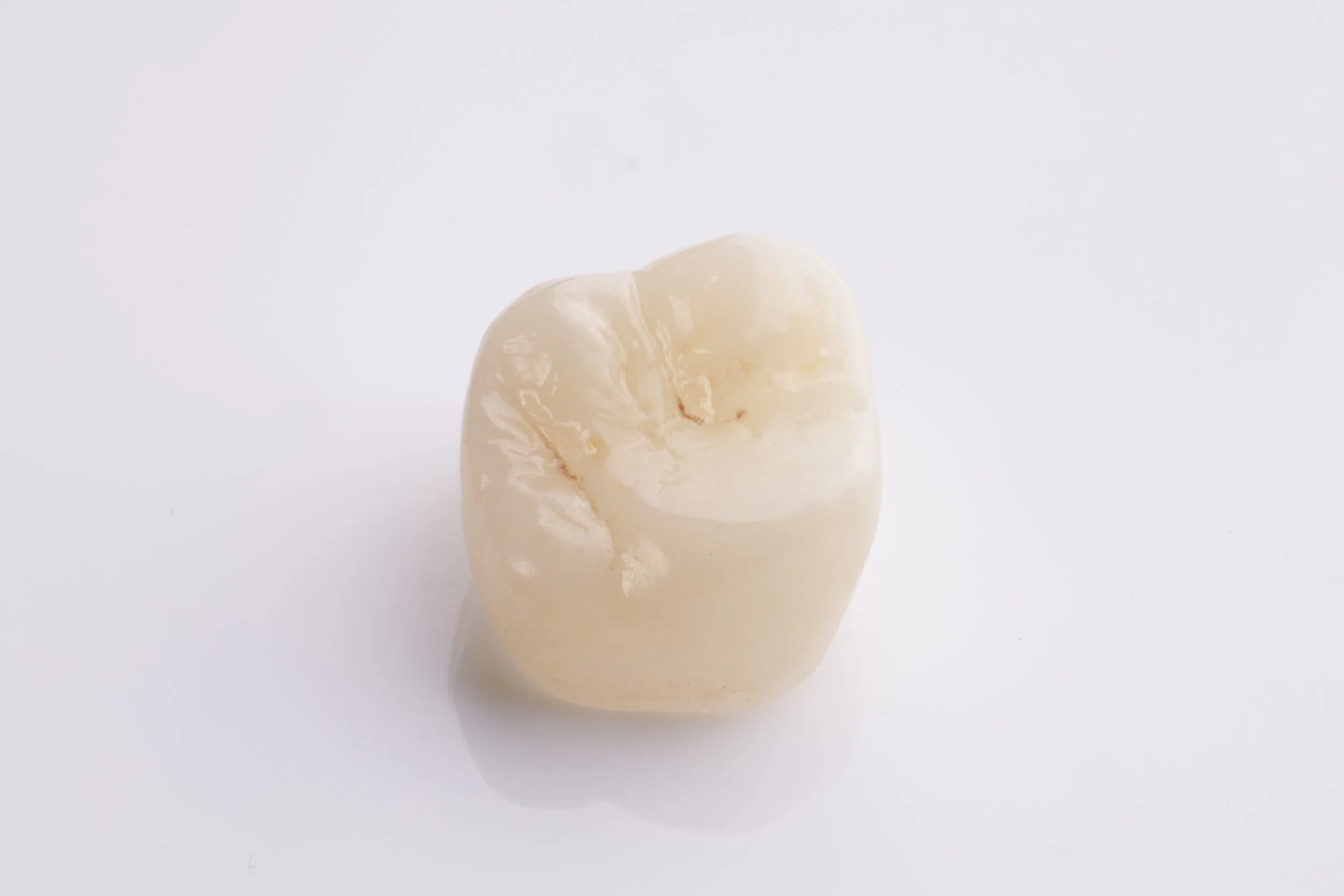 Crowned Teeth Before &amp; After Images