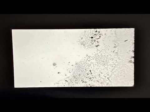 C19 Kelly Cumberland saline trapped slides