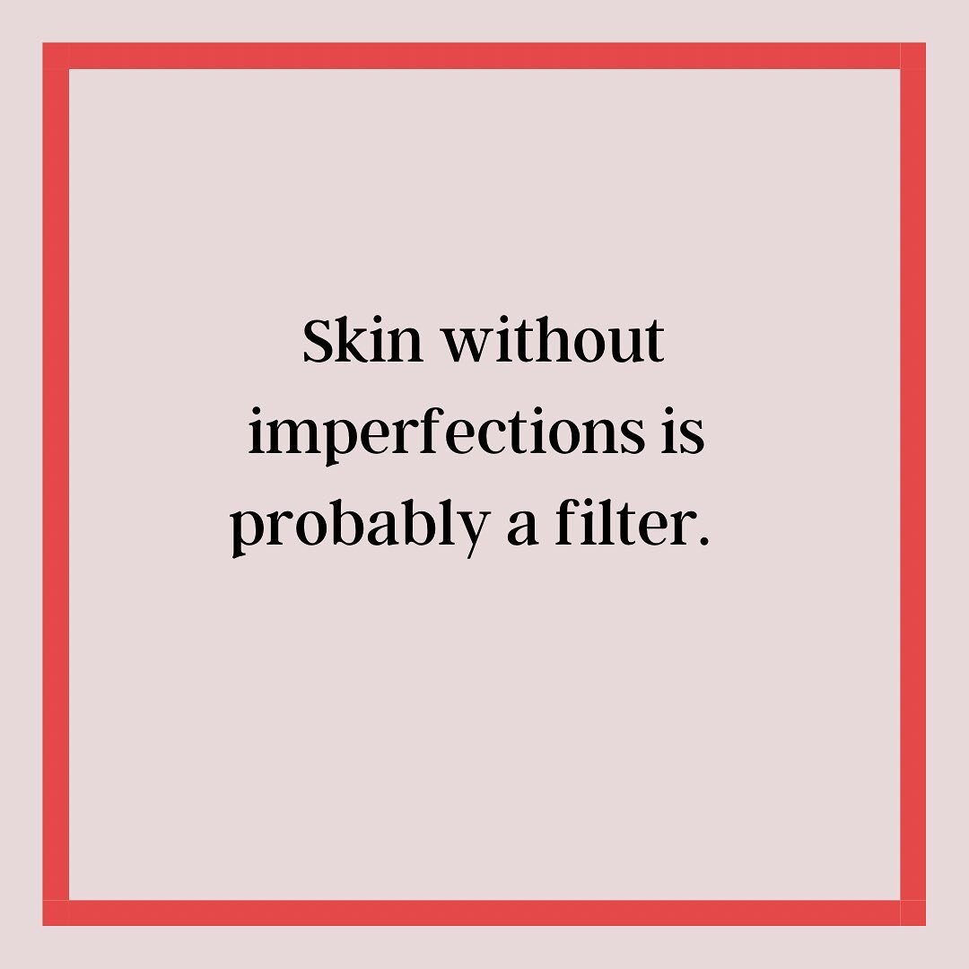 Imperfections are 💯 normal! #realskin #realtalk #skincaretips #skincareisselfcare