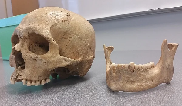 skull1
